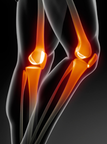 画像:膝関節のイメージ図